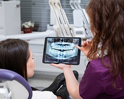 Patient in Dallas talking to dentist about extraction vs a root canal