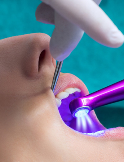 Teen getting a dental sealant