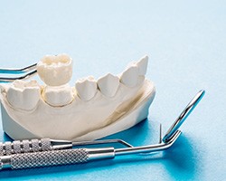 a plaster model of a mouth with a crown being placed on it