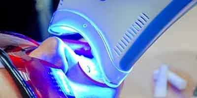 Patient in Dallas getting teeth whitening